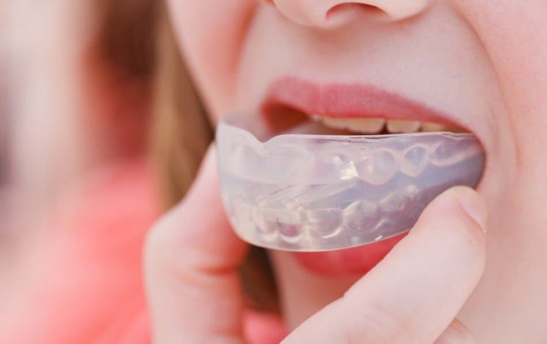 Athletic Mouthguard