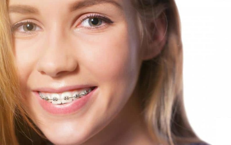 Girl wearing braces
