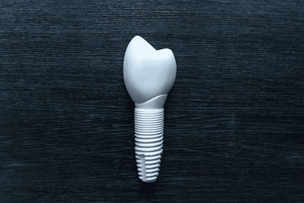 Should I Consider Metal Free Dental Implants in San Diego | SmileHaven Dental Center La Mesa, San Diego CA